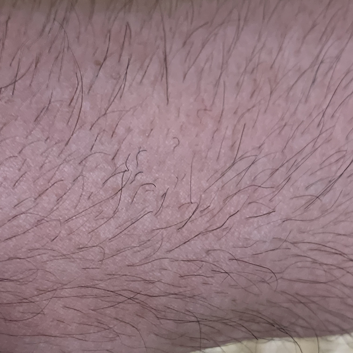 腕の毛の様子