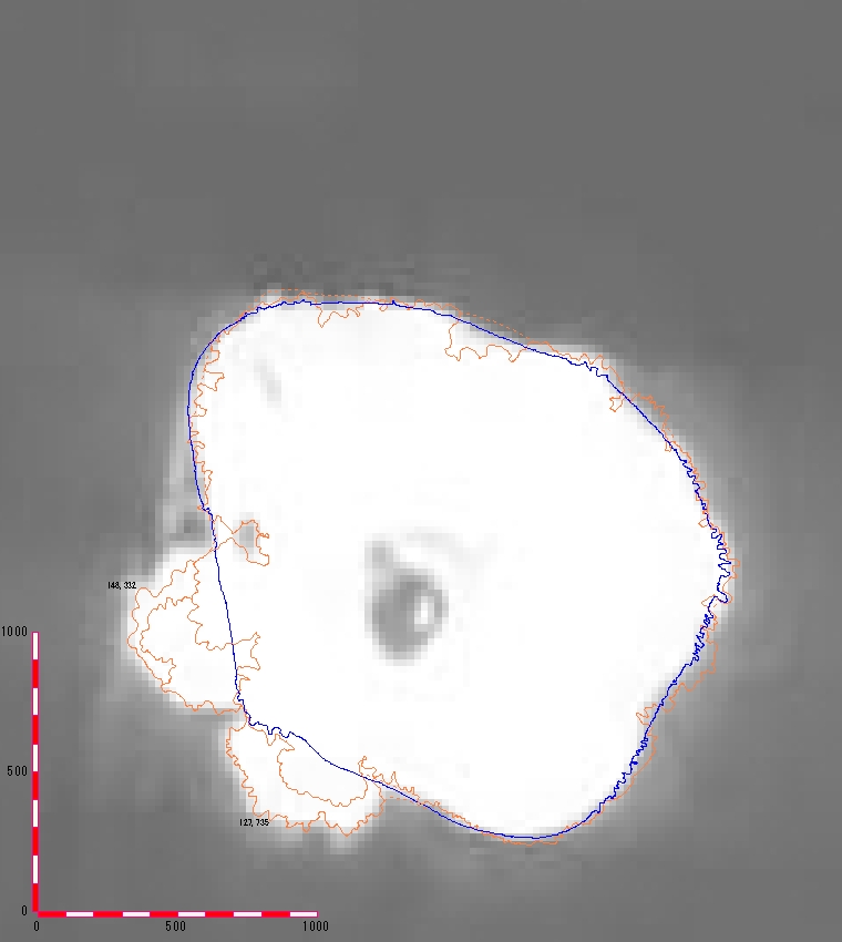 f:id:gravireyossy:20170816170841j:plain f:id:gravireyossy:20170816170841j:plain