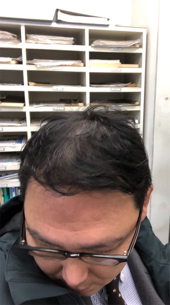 f:id:guangtailang:20191127235856j:image