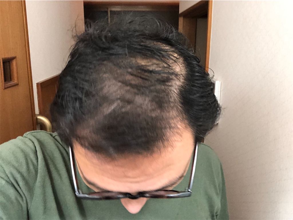 f:id:guangtailang:20210802233912j:image