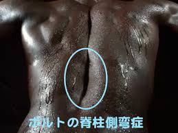 背中に爆弾を背負った世界最速の男ボルトの早すぎる引退 ノーネクタイのmy Way