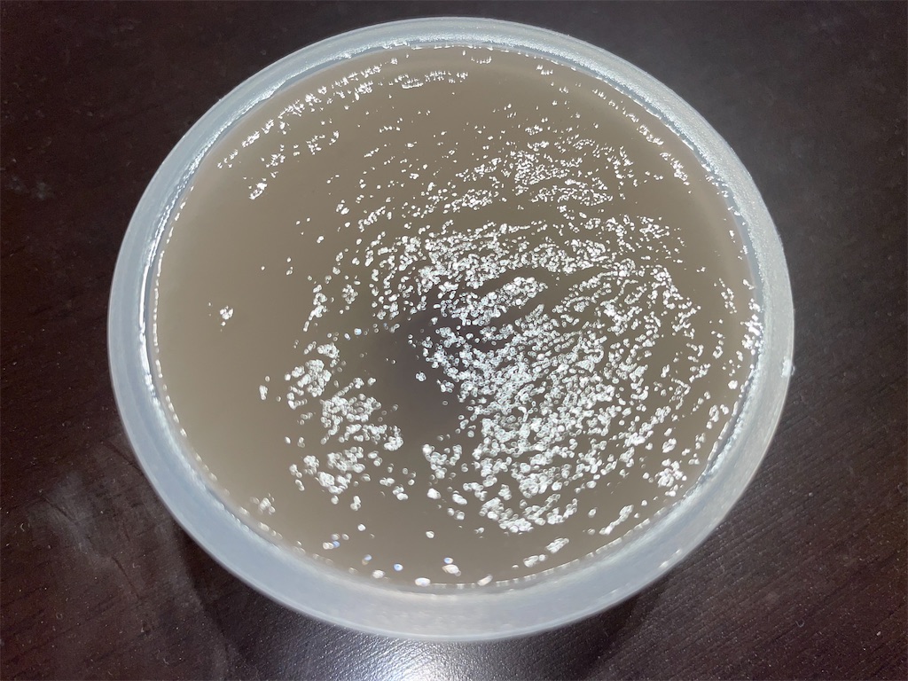 f:id:gurunaBB:20220203073120j:image f:id:gurunaBB:20220203073120j:image