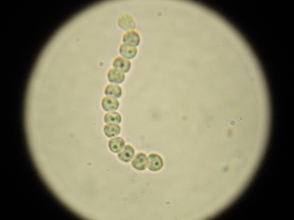 織る フォージ 犯人 イシクラゲ 顕微鏡 Poscon Vp Jp 織る フォージ 犯人 イシクラゲ 顕微鏡 Poscon Vp Jp