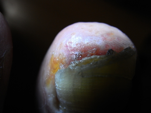 f:id:gzutetsu:20120915191934j:image