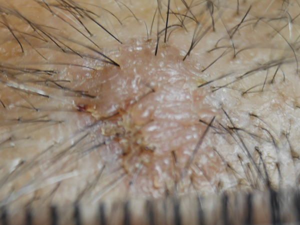 f:id:gzutetsu:20141116133337j:image f:id:gzutetsu:20141116133337j:image