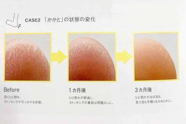 オルビス　ディフェンセラ　かかと