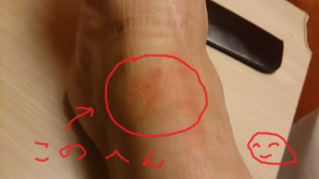 f:id:haberdashery:20150222174937j:image