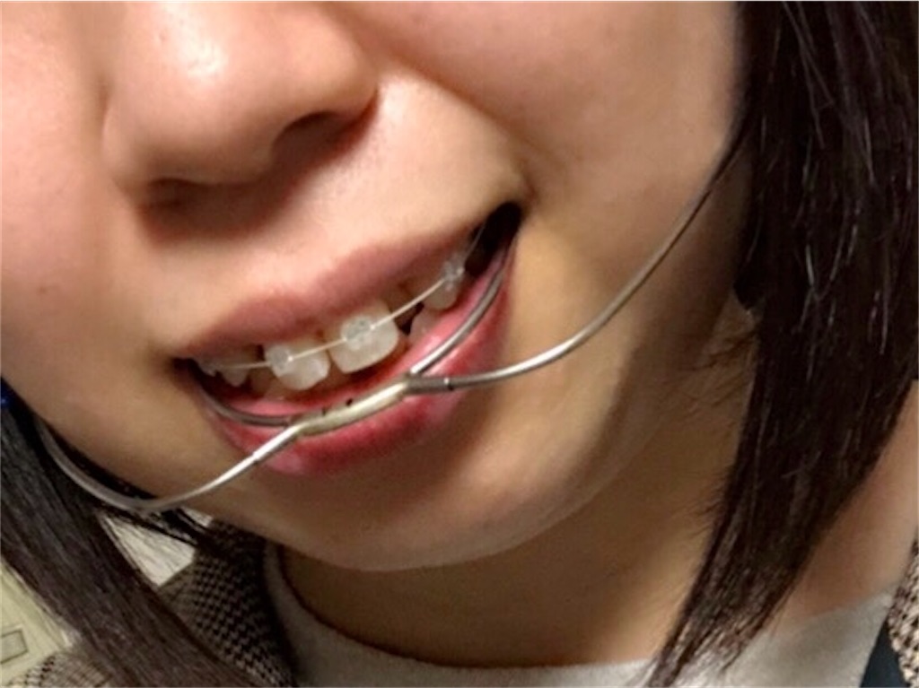 f:id:hachibuta:20201221042011j:image f:id:hachibuta:20201221042011j:image