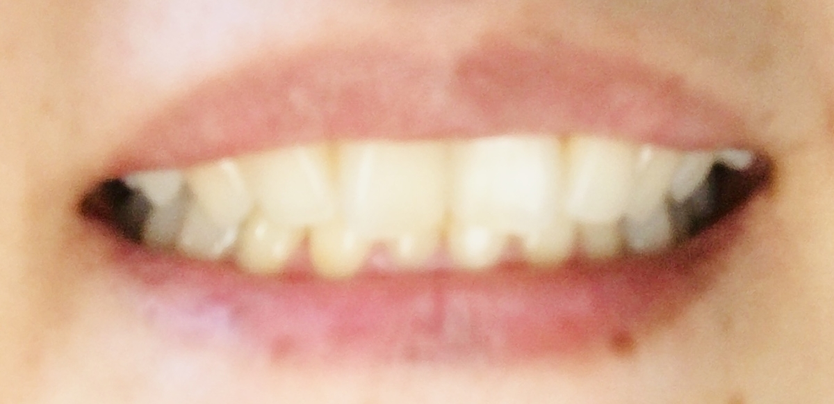 f:id:hahasan0903:20190829103954j:plain f:id:hahasan0903:20190829103954j:plain