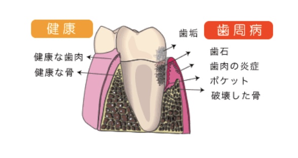 f:id:hamanaseikei:20200325152741j:plain f:id:hamanaseikei:20200325152741j:plain