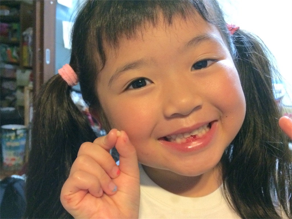 f:id:hamaneko13:20180815173737j:image