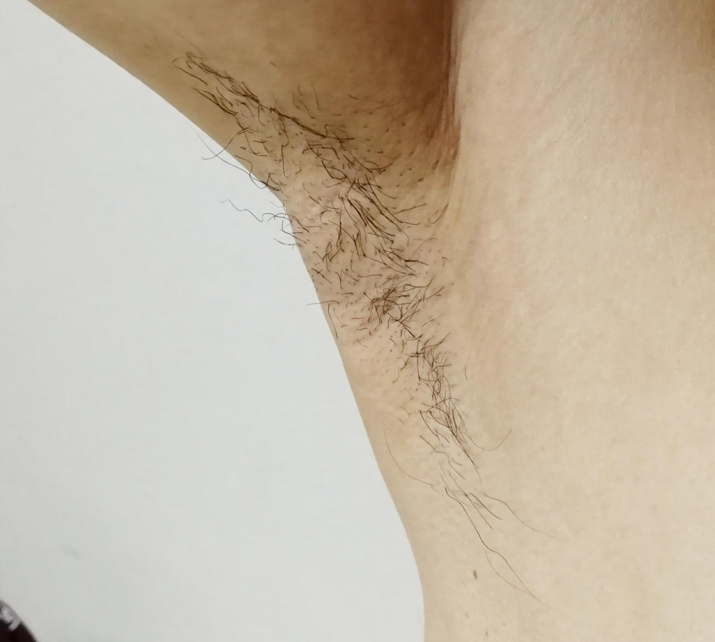 f:id:hamchang:20180504125949j:plain f:id:hamchang:20180504125949j:plain