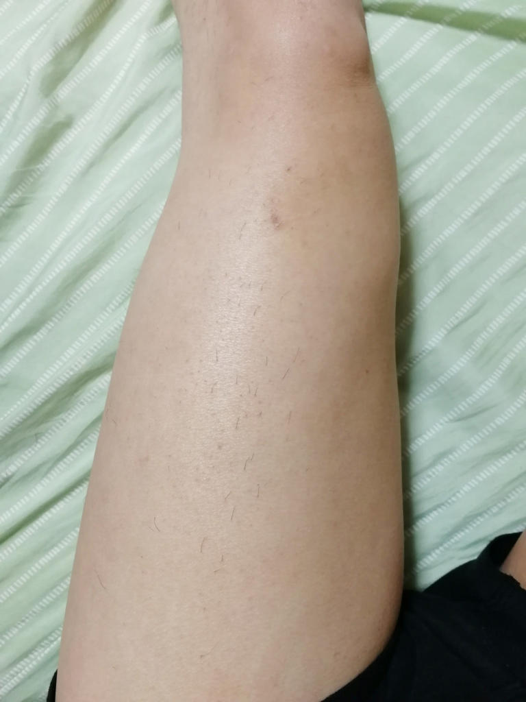 f:id:hamchang:20180507093801j:plain f:id:hamchang:20180507093801j:plain