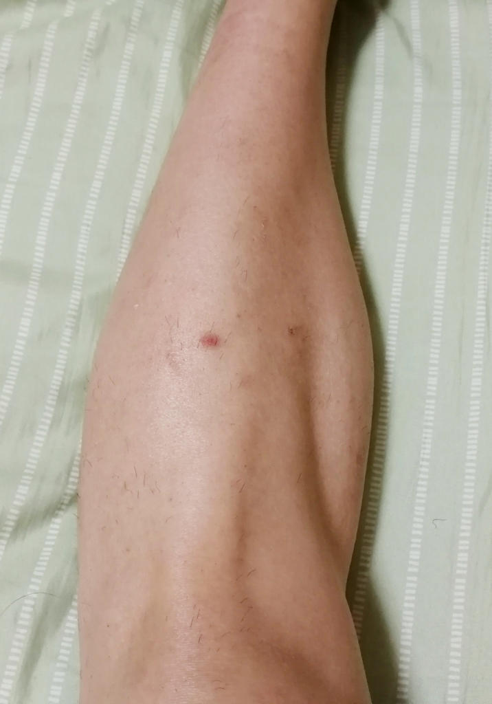 f:id:hamchang:20180507095646j:plain f:id:hamchang:20180507095646j:plain