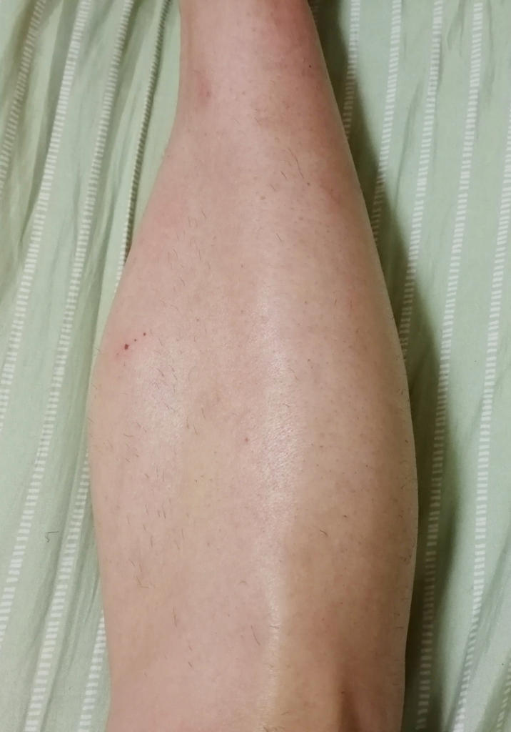 f:id:hamchang:20180507100027j:plain f:id:hamchang:20180507100027j:plain
