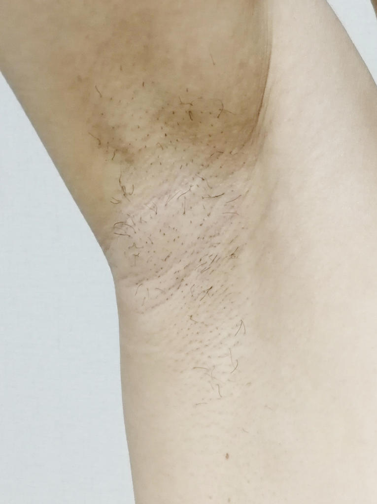 f:id:hamchang:20180521083726j:plain f:id:hamchang:20180521083726j:plain