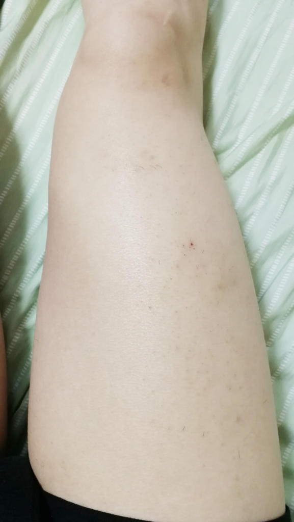 f:id:hamchang:20180521225404j:plain f:id:hamchang:20180521225404j:plain