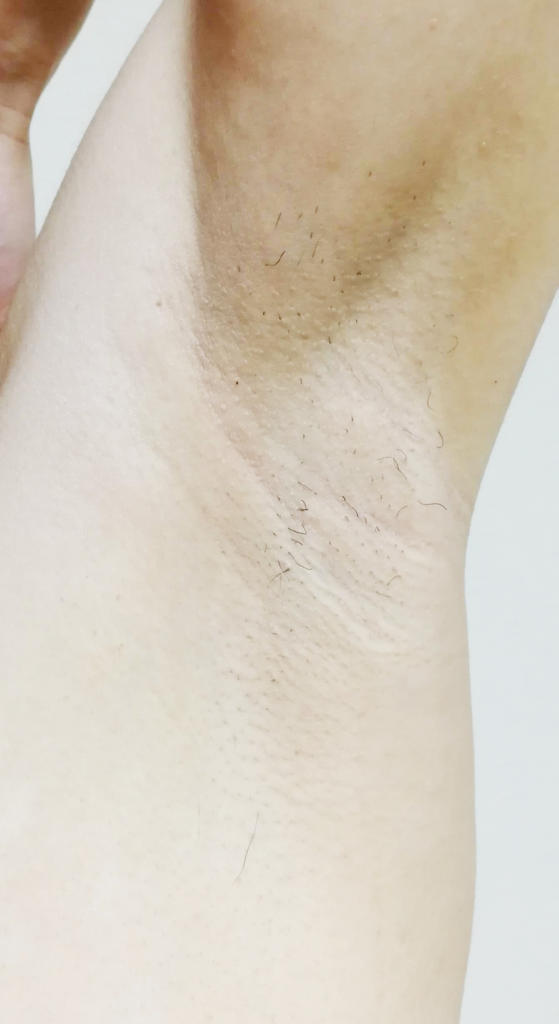 f:id:hamchang:20180729221131j:plain f:id:hamchang:20180729221131j:plain