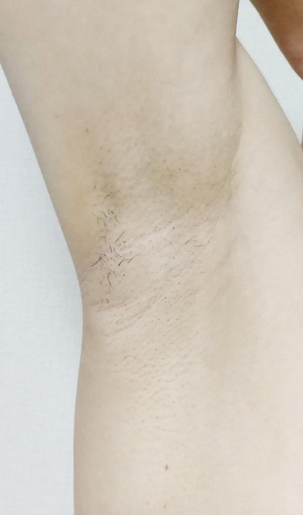 f:id:hamchang:20180729221157j:plain f:id:hamchang:20180729221157j:plain