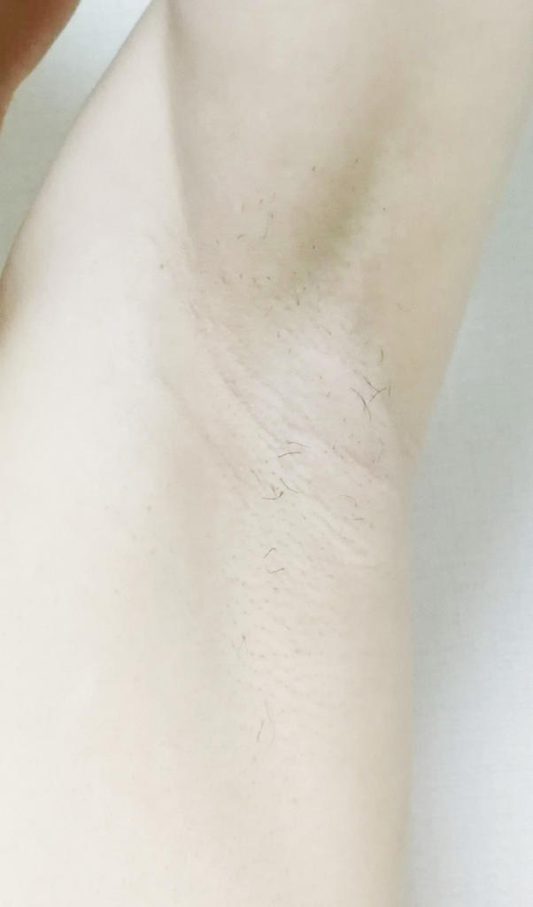 f:id:hamchang:20180729221237j:plain f:id:hamchang:20180729221237j:plain
