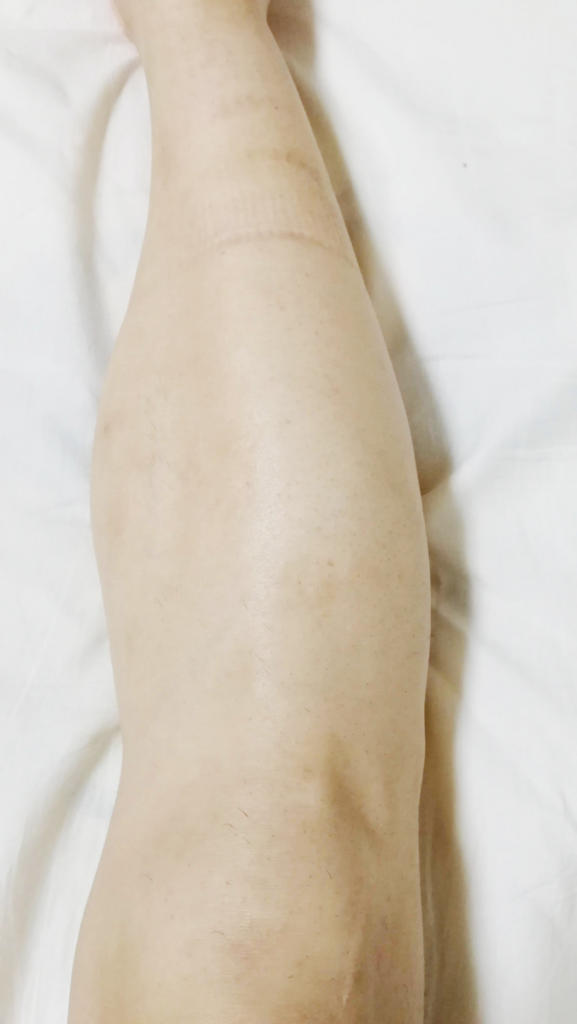 f:id:hamchang:20180729222440j:plain f:id:hamchang:20180729222440j:plain
