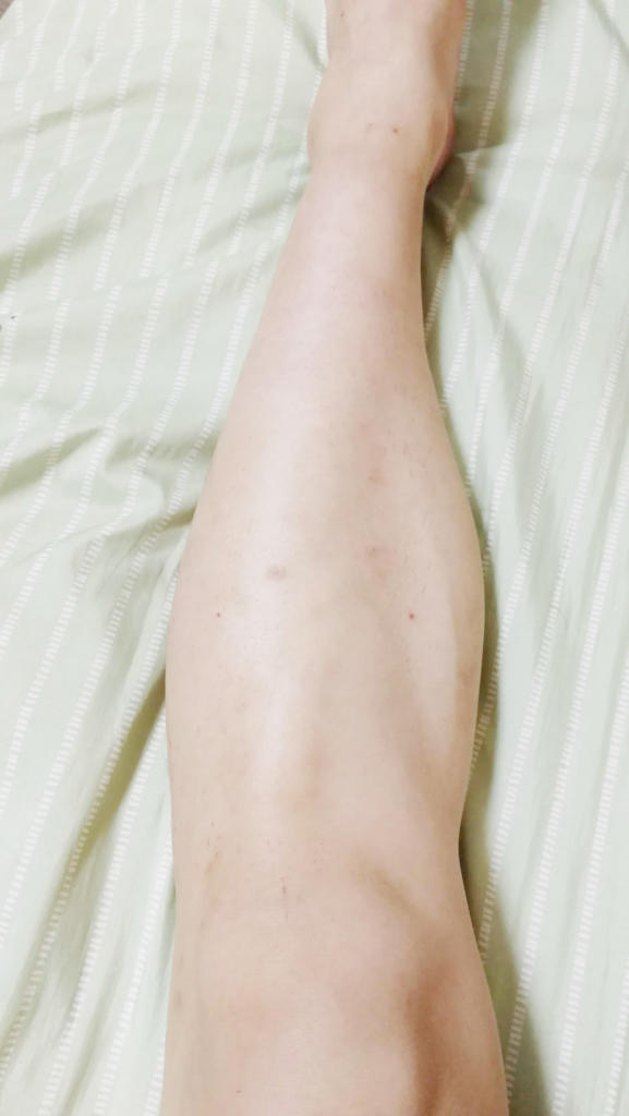 f:id:hamchang:20180729223254j:plain f:id:hamchang:20180729223254j:plain