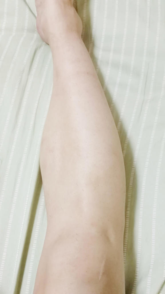f:id:hamchang:20180729223317j:plain f:id:hamchang:20180729223317j:plain