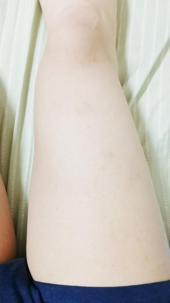 f:id:hamchang:20180729223403j:plain f:id:hamchang:20180729223403j:plain