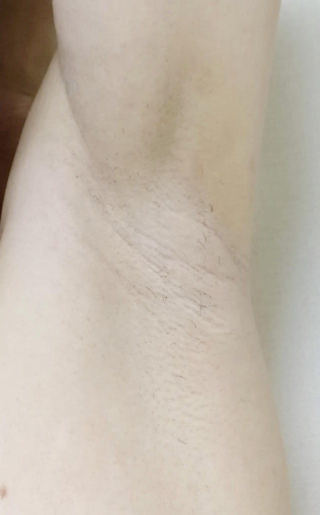 f:id:hamchang:20180805160035j:plain f:id:hamchang:20180805160035j:plain