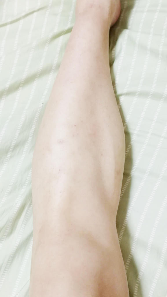 f:id:hamchang:20180812230440j:plain f:id:hamchang:20180812230440j:plain