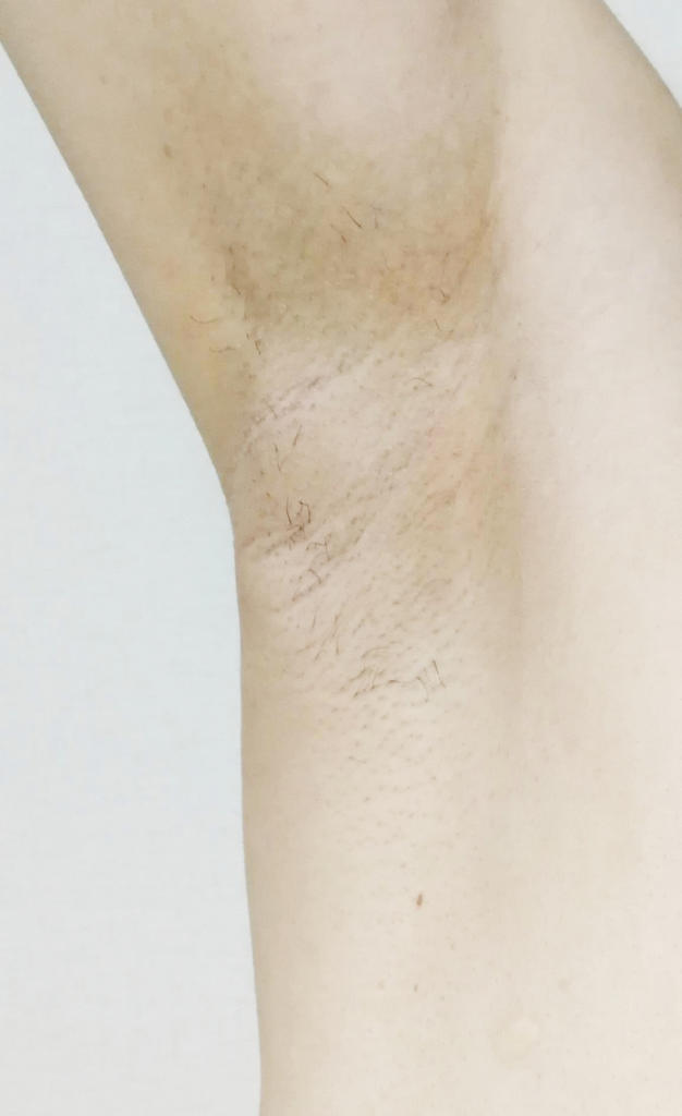 f:id:hamchang:20180819210224j:plain f:id:hamchang:20180819210224j:plain