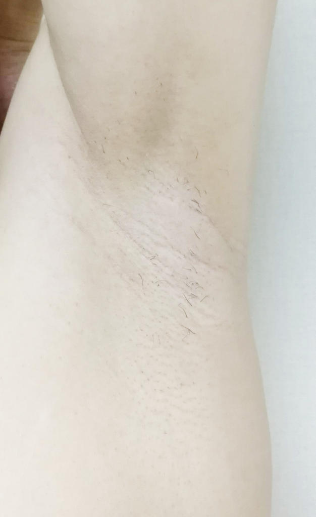 f:id:hamchang:20180819210241j:plain f:id:hamchang:20180819210241j:plain