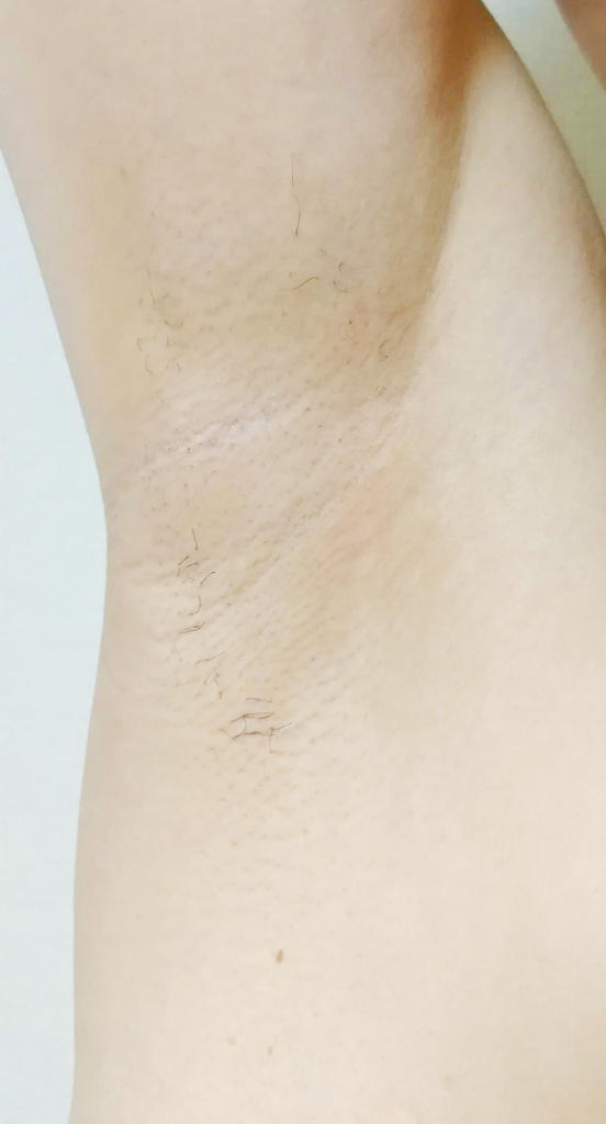 f:id:hamchang:20180904150016j:plain f:id:hamchang:20180904150016j:plain