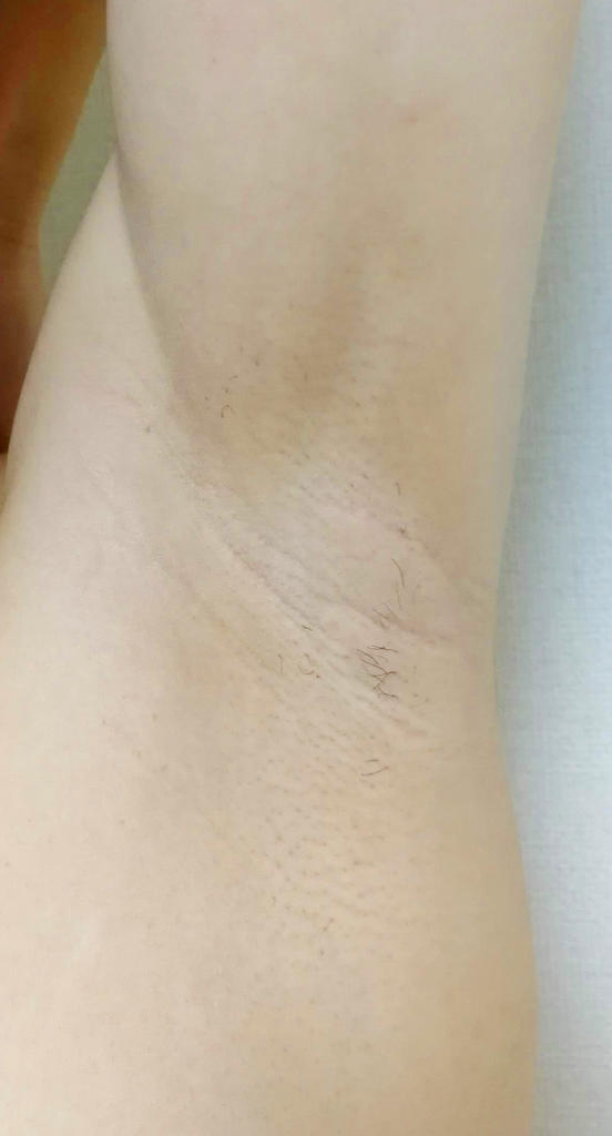 f:id:hamchang:20180904150040j:plain f:id:hamchang:20180904150040j:plain