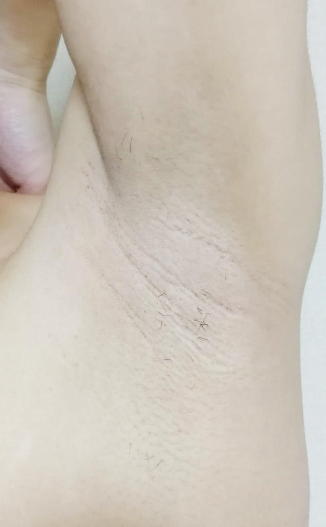 f:id:hamchang:20180918221249j:plain f:id:hamchang:20180918221249j:plain