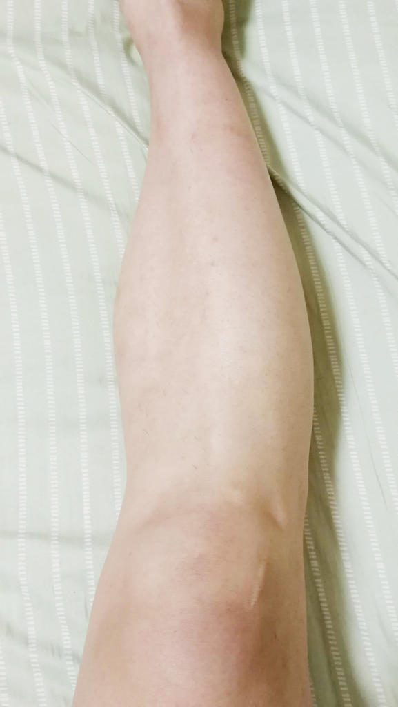 f:id:hamchang:20180924220222j:plain f:id:hamchang:20180924220222j:plain