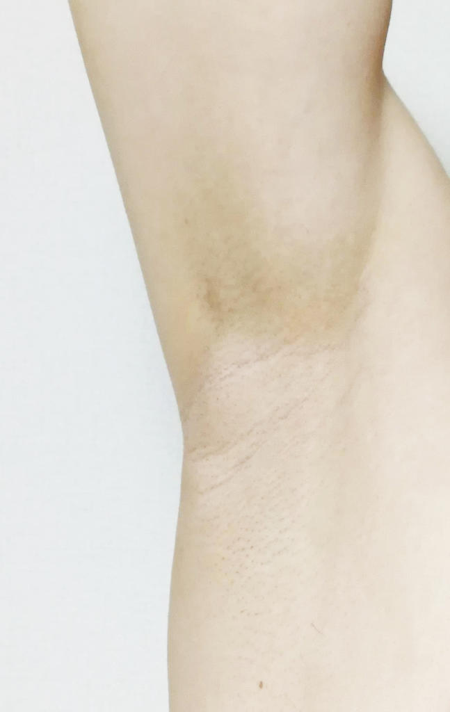 f:id:hamchang:20181001213843j:plain f:id:hamchang:20181001213843j:plain