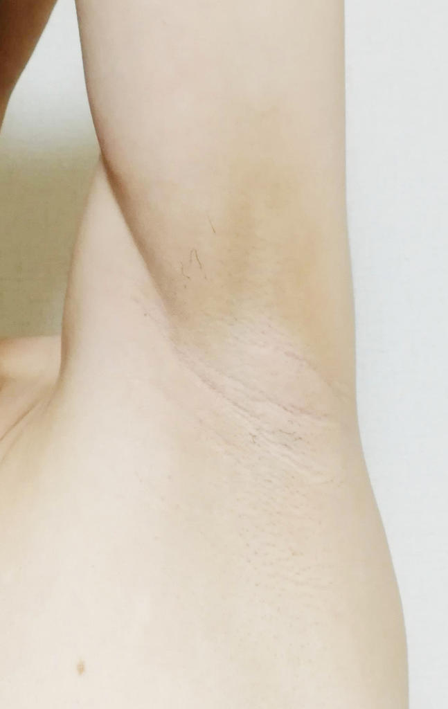 f:id:hamchang:20181001213902j:plain f:id:hamchang:20181001213902j:plain