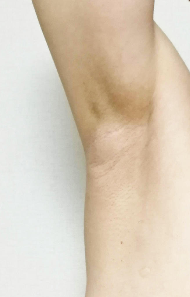 f:id:hamchang:20181013234228j:plain f:id:hamchang:20181013234228j:plain