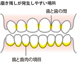 f:id:hamigaki8020:20161222145455j:plain
