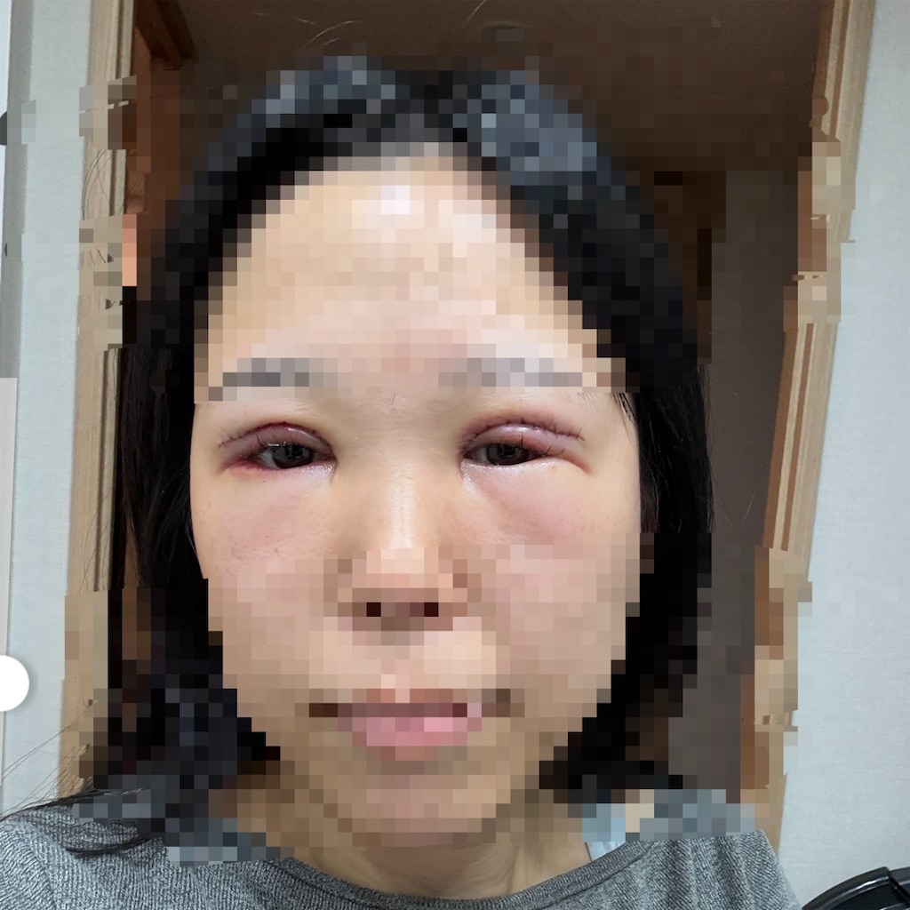 f:id:hamtarosan:20251120232754j:image