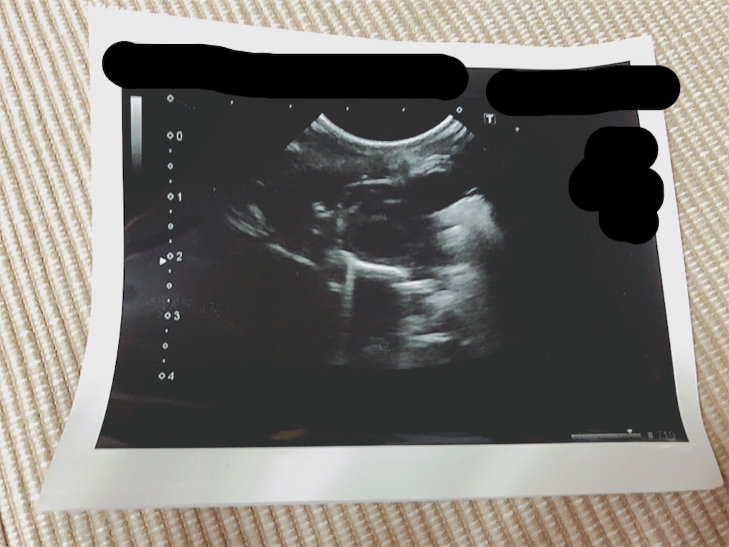 f:id:hamuyashiki:20191204184314j:image f:id:hamuyashiki:20191204184314j:image