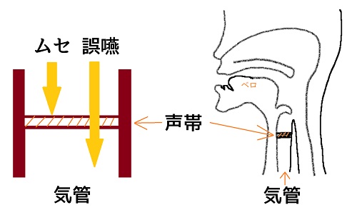 「ムセ」と「誤嚥」の違いとは?いまさら聞けない食事支援の基礎知識 - 言語聴覚士は放課後等デイサービスで何ができる?