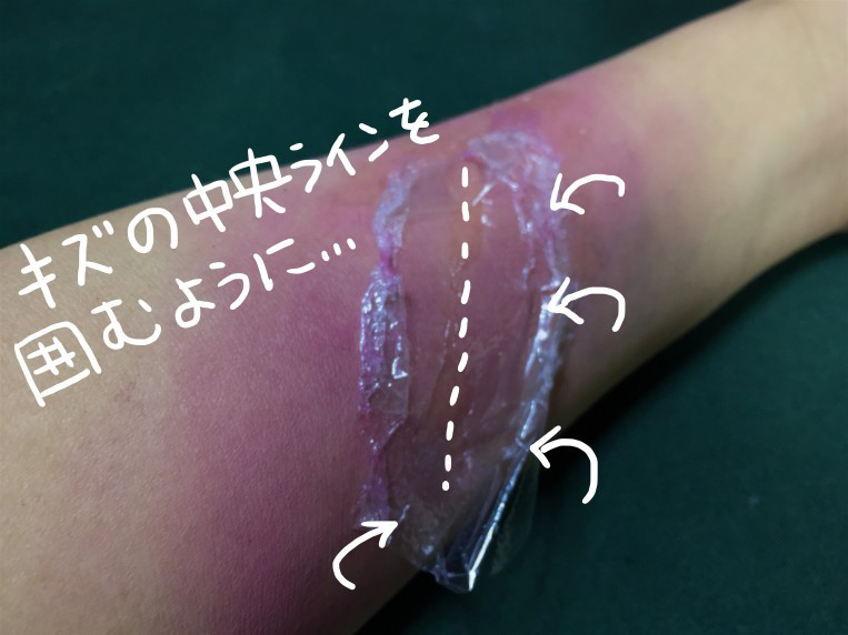 f:id:hanaekiryuin:20161019105253j:plain f:id:hanaekiryuin:20161019105253j:plain