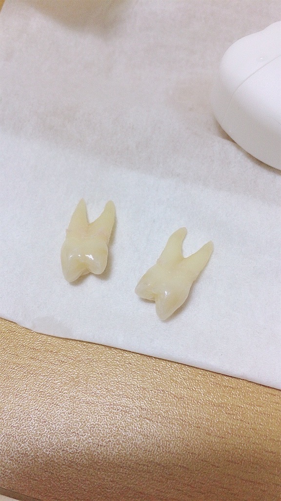 f:id:hanarabi_8020:20201126173143j:image