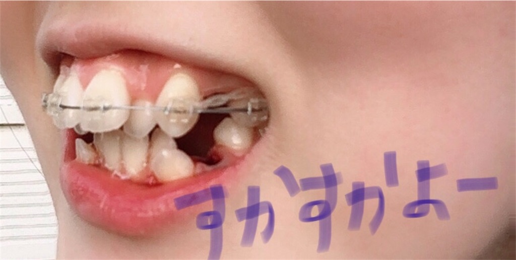f:id:hanarabi_8020:20201230172907j:image