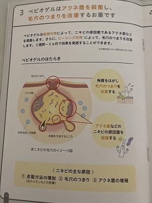 3ベピオゲルは殺菌して毛穴のつまりを改善する