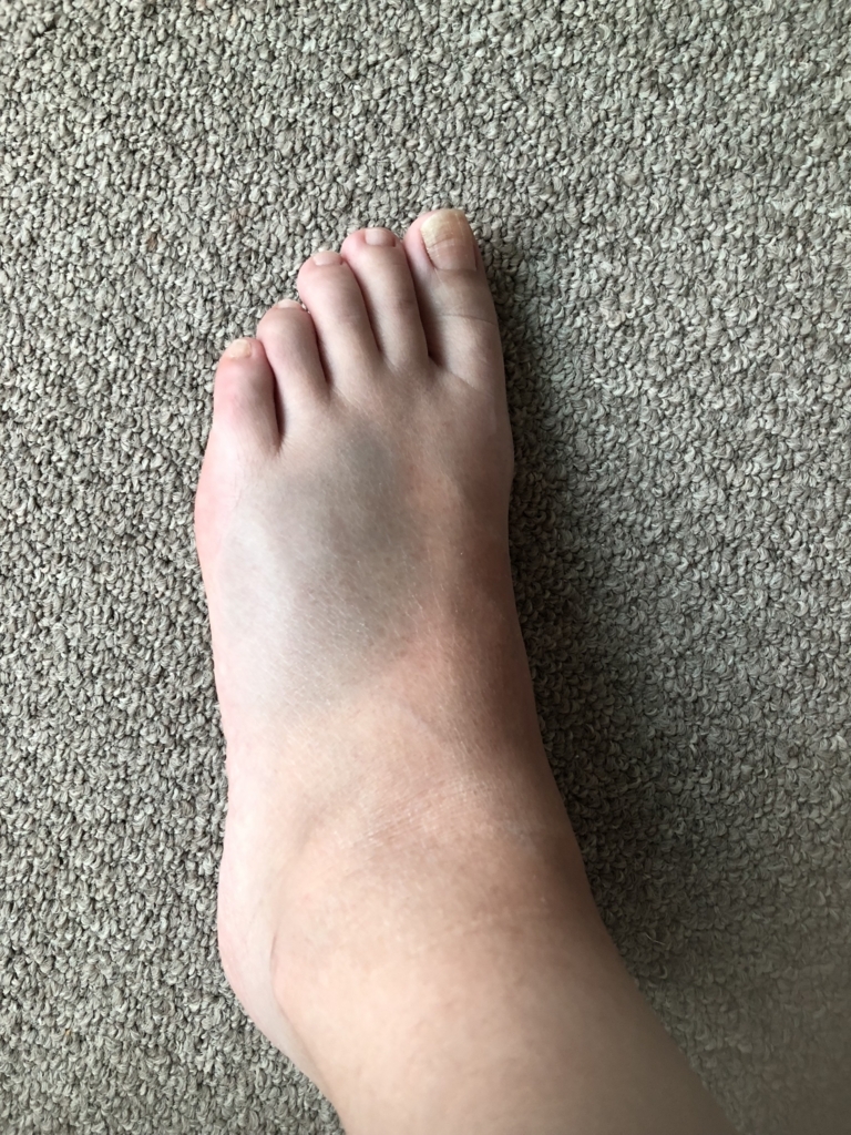 f:id:hanatarehanatan:20180608195120j:plain