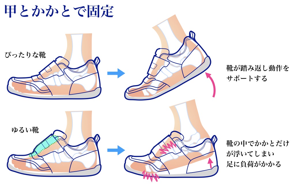 甲とかかとで固定する図（引用）