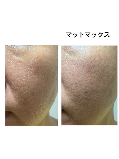 f:id:hapinity-skin:20251112101413j:image